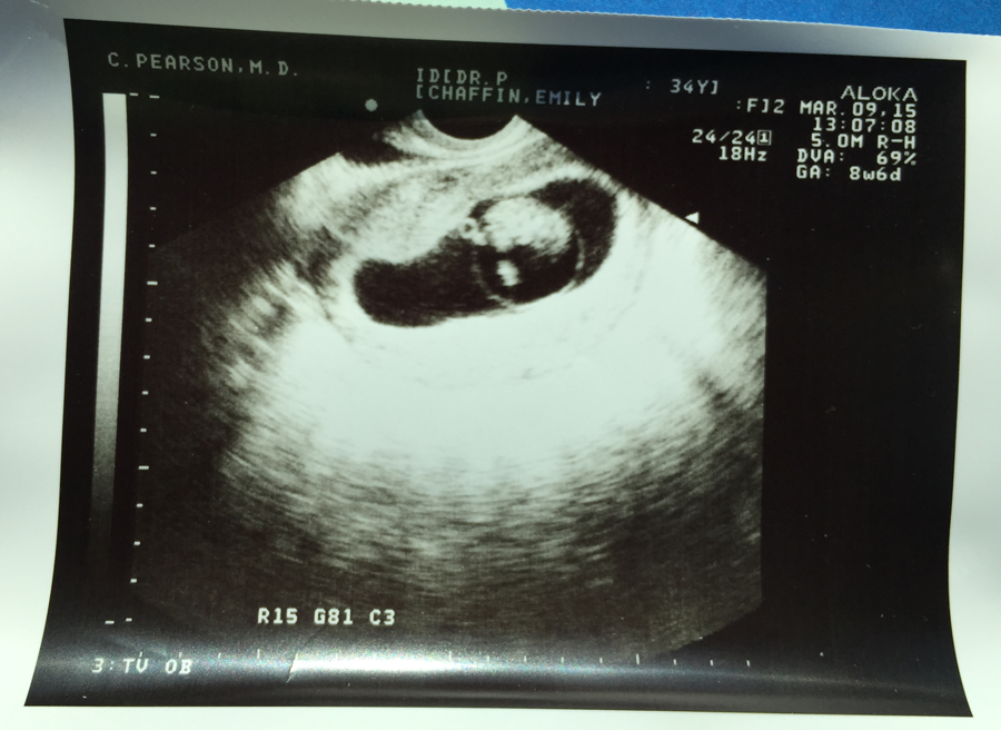  photo 14-Baby-Blog-Post_zpsn8gdrh23.png