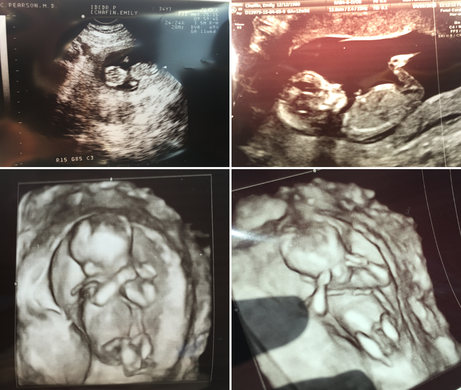  photo 2-Baby-Blog-Post_zps5hnbj6p5.png